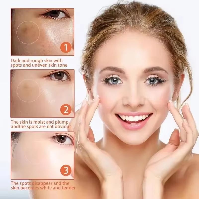 Skuteczny krem wybielający na  – Charcoal Whitening Paste recenzja i cena