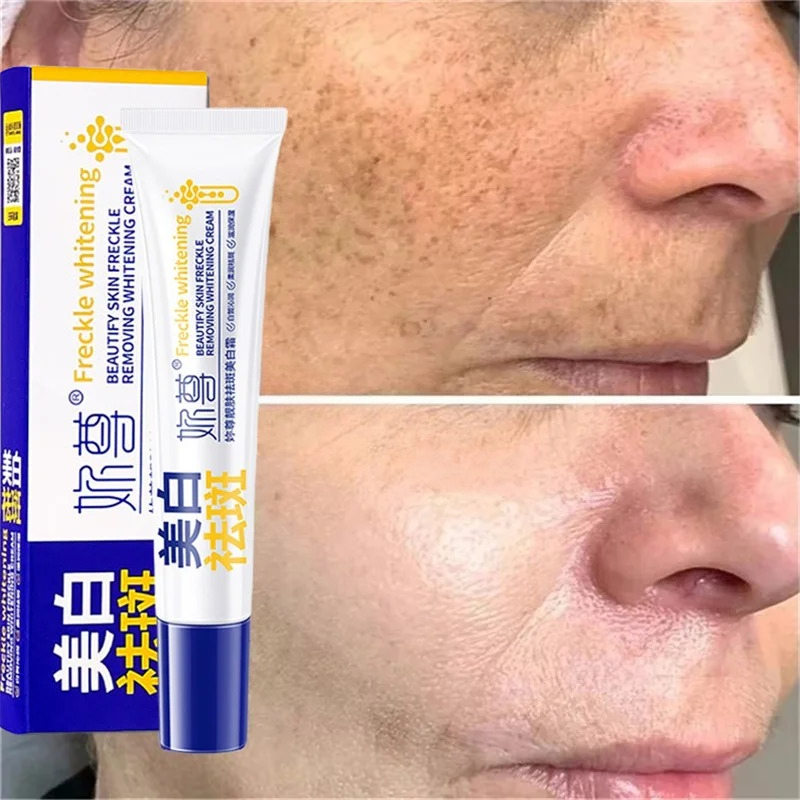 Skuteczny krem wybielający na  – Charcoal Whitening Paste recenzja i cena