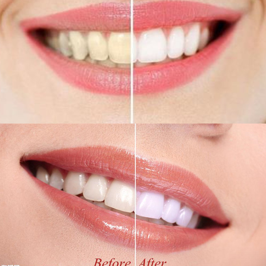 Bambusowy węgiel drzewny zęby  – Teeth Whitening Filter recenzja i cena