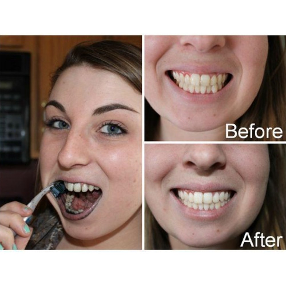 Bambusowy węgiel drzewny zęby  – Teeth Whitening Filter recenzja i cena