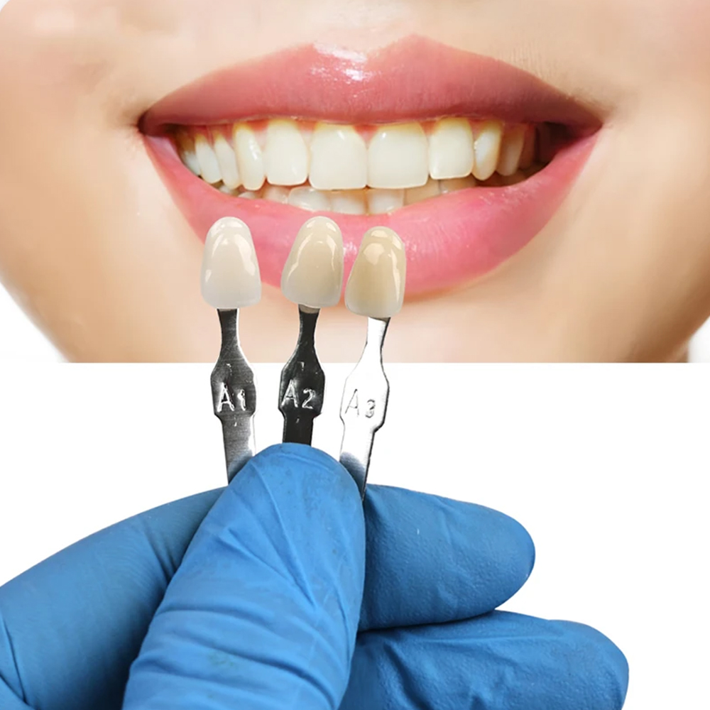 VITA 16 Kolorów Przyrząd do Od – Teeth Whitening Shade Guide recenzja i cena