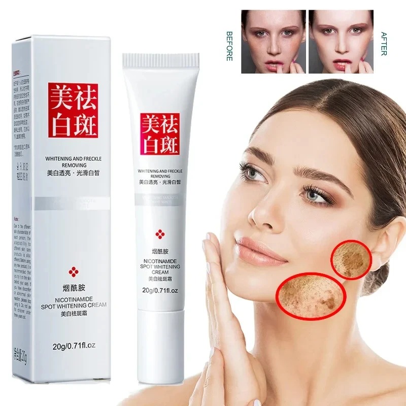 Znikają i poprawia piegi Czarn – Charcoal Whitening Paste recenzja i cena