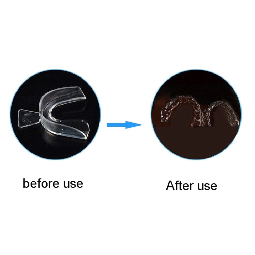 2/4 szt. Miękkie aparaty ortod – Teeth Whitening Mouth Guard recenzja i cena