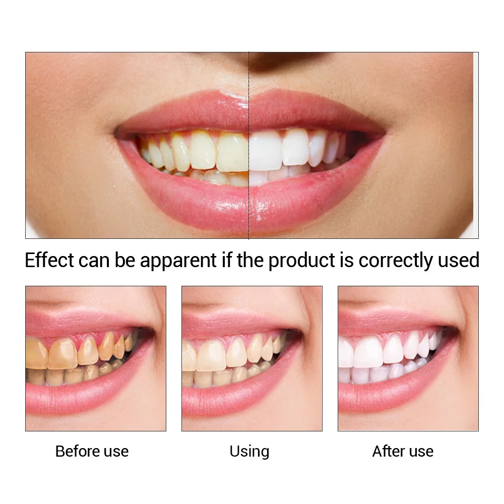 FTEENPLY esencja do wybielania – Teeth Whitening Vape recenzja i cena