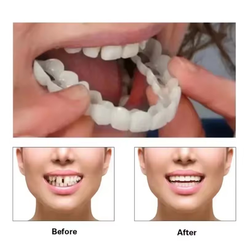 Okładziny na zęby Wybielanie z – Teeth Whitening Vape recenzja i cena