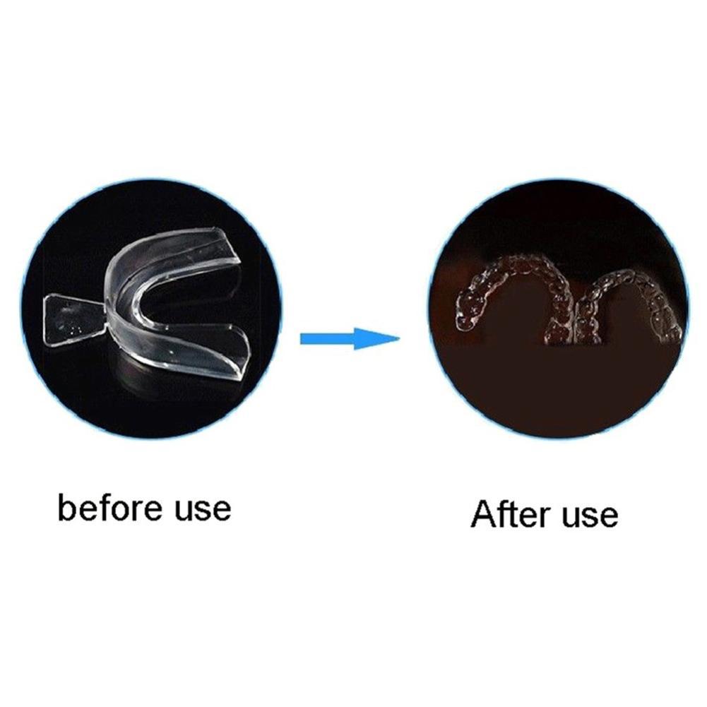 Silikonowa Ochraniacz na Zęby  – Teeth Whitening Mouth Guard recenzja i cena