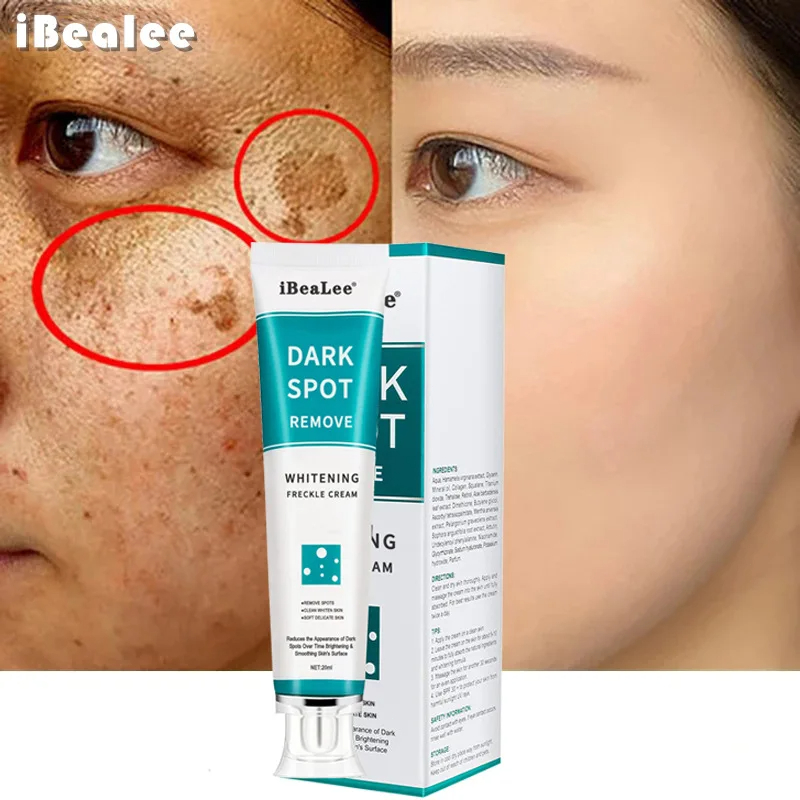 Wybielający krem ​​do piegów U – Charcoal Whitening Paste recenzja i cena