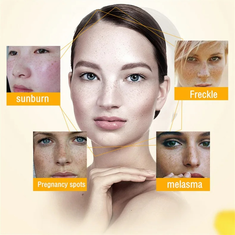 Wybielający krem ​​do piegów U – Charcoal Whitening Paste recenzja i cena