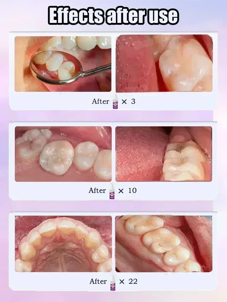 Pasta do czyszczenia zębów usu – Teeth Whitening Charcoal Powder recenzja i cena