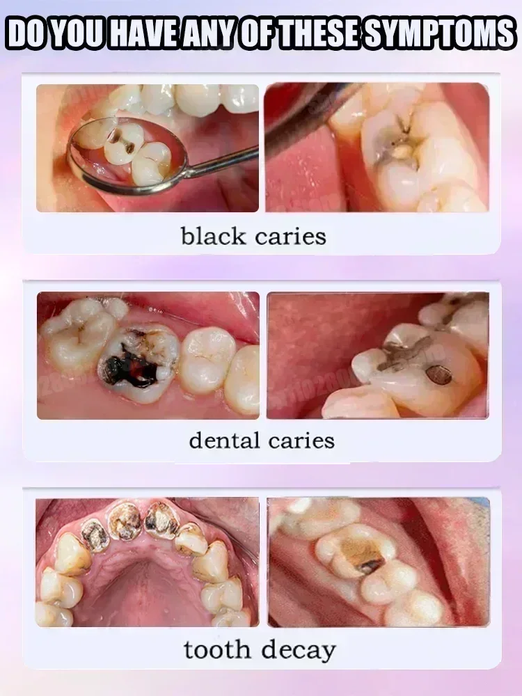Pasta do czyszczenia zębów usu – Teeth Whitening Charcoal Powder recenzja i cena