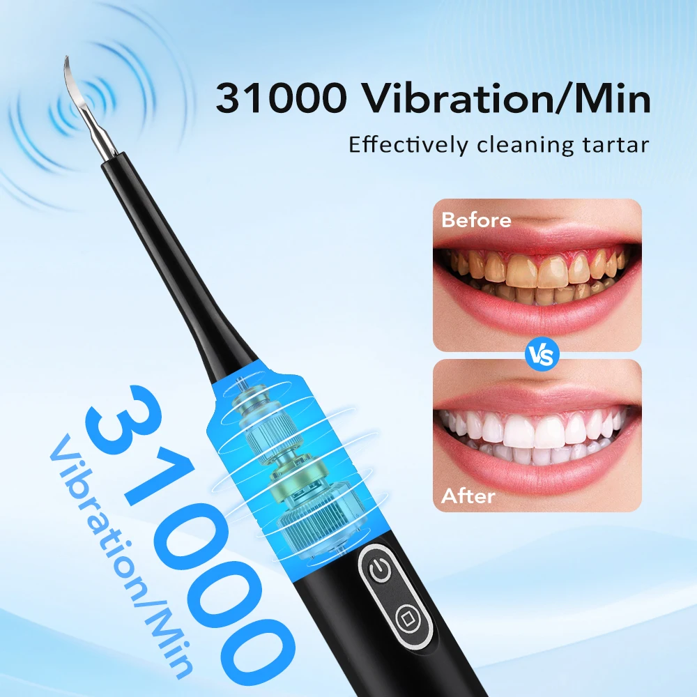 Elektryczny soniczny skaler de – Teeth Whitening Professional recenzja i cena